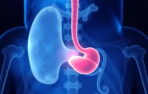 Как избавиться от камней в желчном: понятные шаги к здоровью